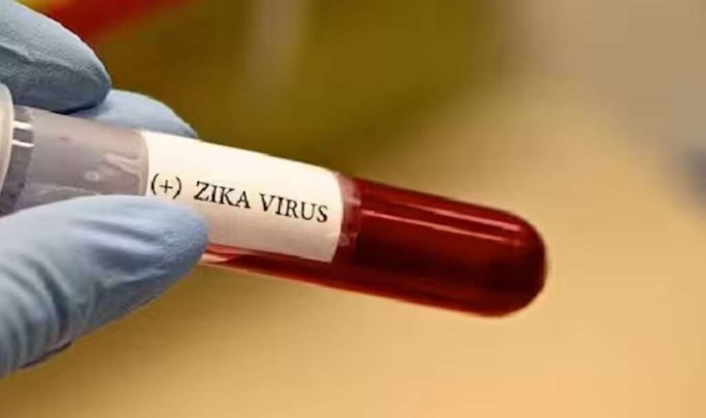 ಚಿಕ್ಕಬಳ್ಳಾಪುರ ಜಿಲ್ಲೆಯಲ್ಲಿ ಝೀಕಾ ವೈರಸ್ ಪತ್ತೆಯಾಗಿದೆ.